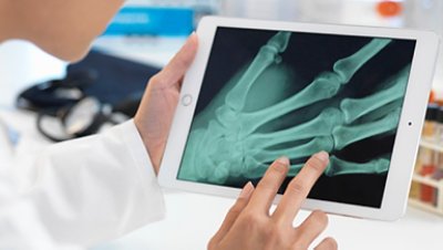 An X-ray image of a hand on a tablet
